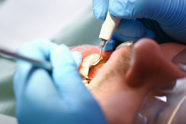 Best Emergency Gum Treatment in Fox Point, WI