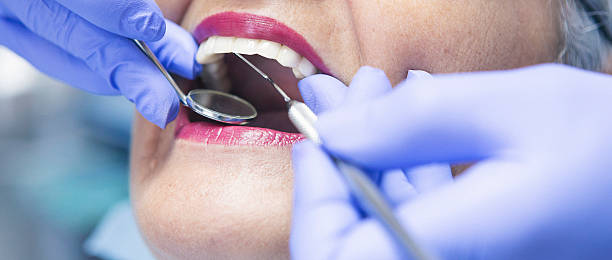 Best Emergency Dental Care for Broken or Chipped Teeth in Fox Point, WI